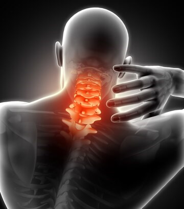 Síndrome Cervicobraquial ou Cervicobraquialgia